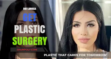 Did Larissa Get Plastic Surgery? Uncovering the Truth Behind Her Transformation