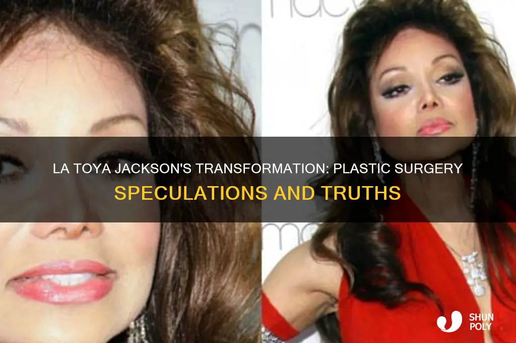 did latoya have plastic surgery