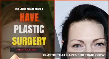 Laura Prepon's Transformation: Plastic Surgery Rumors Explored