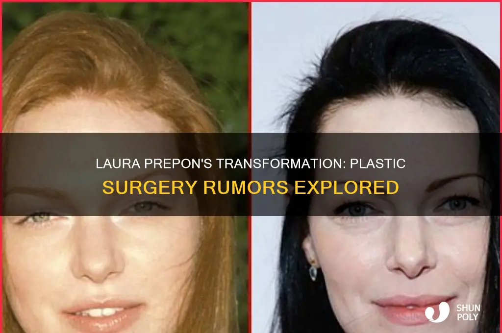 did laura helene prepon have plastic surgery