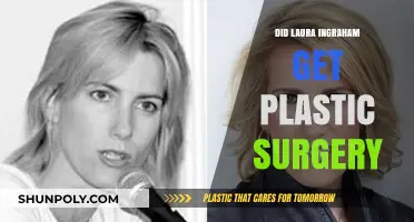 Laura Ingraham Plastic Surgery: Fact-Checking the Rumors and Speculations