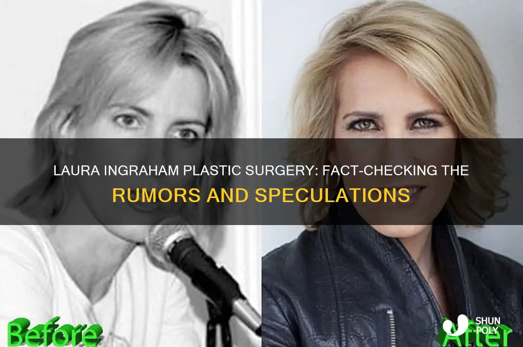 did laura ingraham get plastic surgery