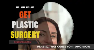 Laura Mellado's Transformation: Plastic Surgery Rumors Explored