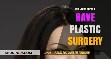 Laura Prepon's Transformation: Plastic Surgery Rumors Explored and Debunked