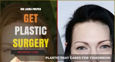 Laura Prepon Plastic Surgery: Fact-Checking the Transformation Rumors