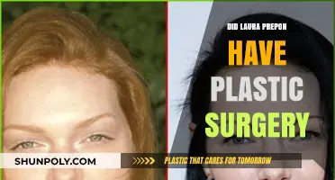 Laura Prepon's Transformation: Plastic Surgery Rumors Explored and Debunked