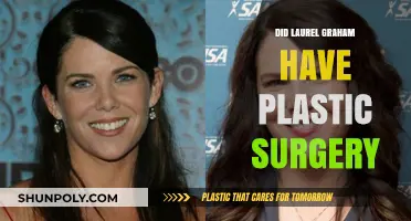 Laurel Graham's Transformation: Plastic Surgery Speculations and Truths