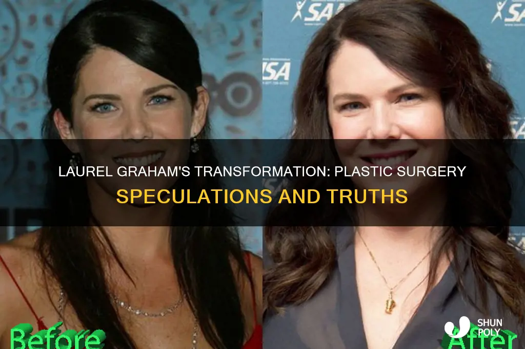 did laurel graham have plastic surgery