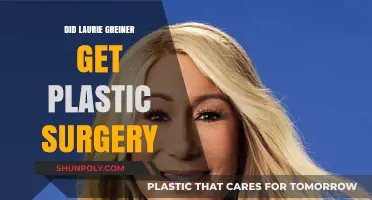 Laurie Greiner's Transformation: Plastic Surgery Rumors Explored