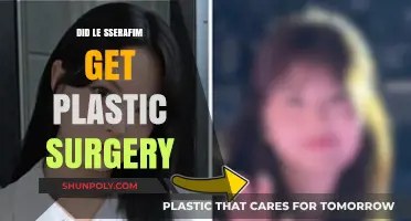 Le Sserafim's Transformation: Plastic Surgery Speculations and Truths