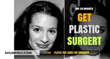 Lea Michele's Transformation: Plastic Surgery Rumors Explored
