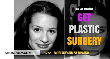 Lea Michele's Transformation: Plastic Surgery Rumors Explored