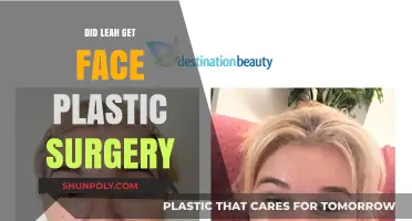 Leah's Transformation: Unveiling the Truth About Her Facial Plastic Surgery