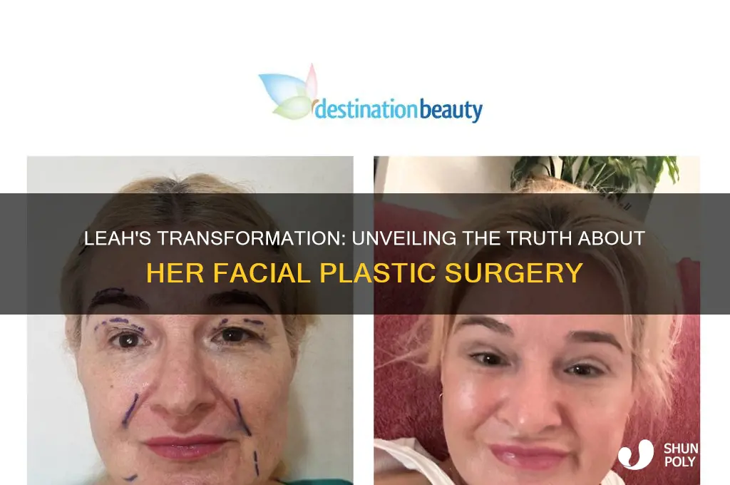 did leah get face plastic surgery