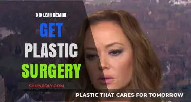Leah Remini Plastic Surgery: Fact-Checking Her Transformation Rumors