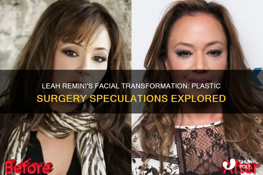 did leah remini have plastic surgery on her face