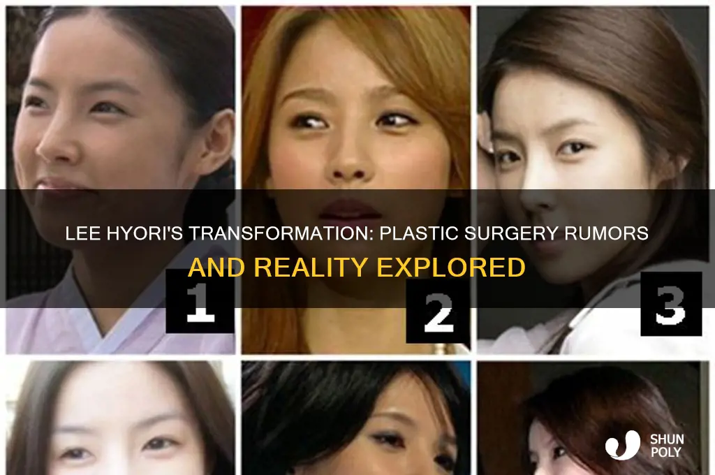 did lee hyori get plastic surgery
