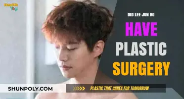 Lee Jun Ho's Transformation: Plastic Surgery Rumors Explored