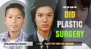Lee Min Ho's Transformation: Plastic Surgery Rumors Explored