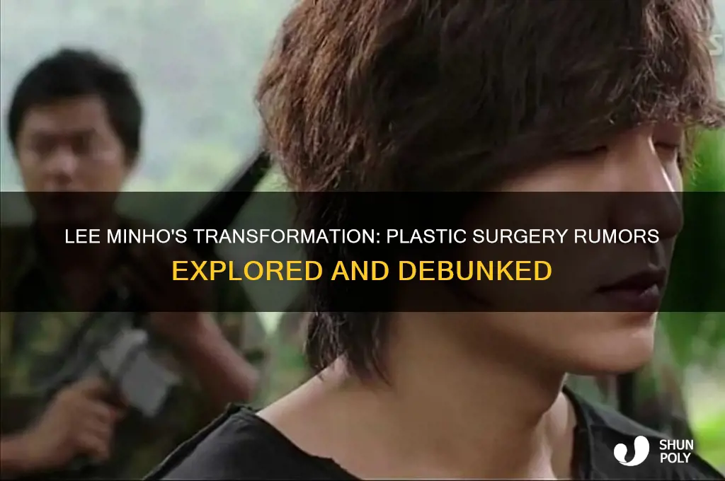 did lee minho get plastic surgery