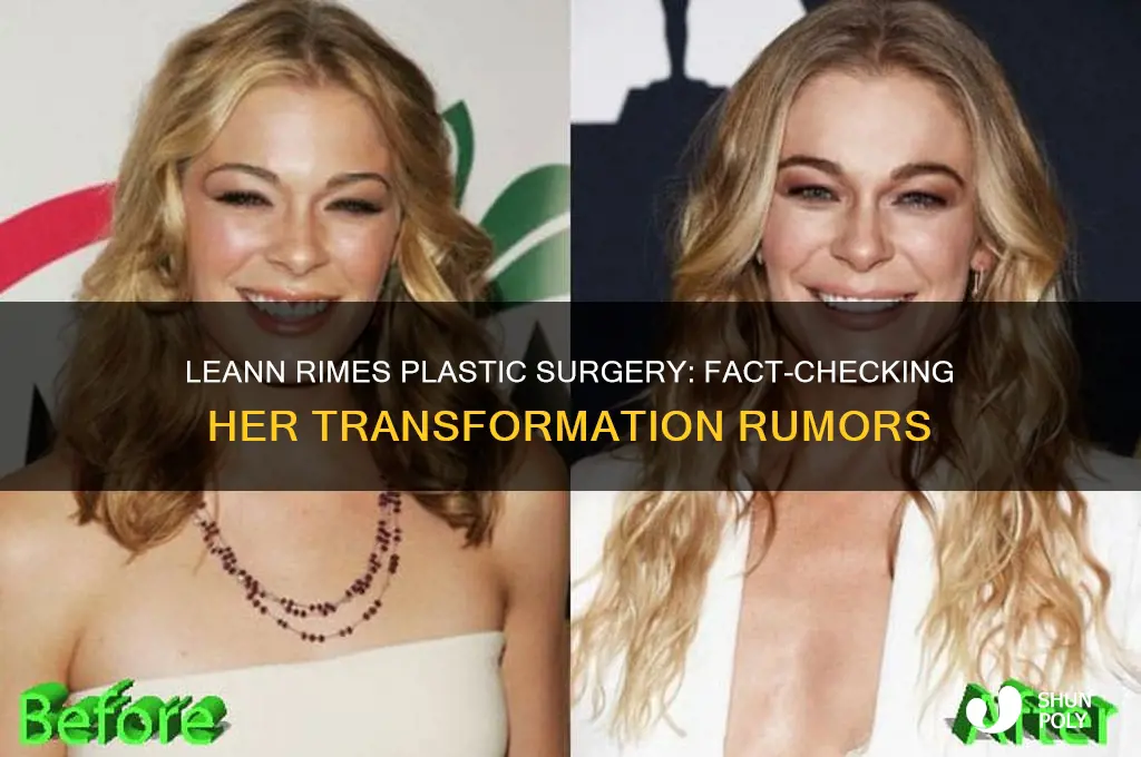 did leeanne rimes have plastic surgery