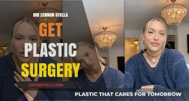 Lennon Stella Plastic Surgery Rumors: Fact-Checking the Speculations