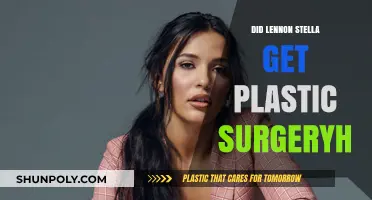Lennon Stella Plastic Surgery Rumors: Fact or Fiction?