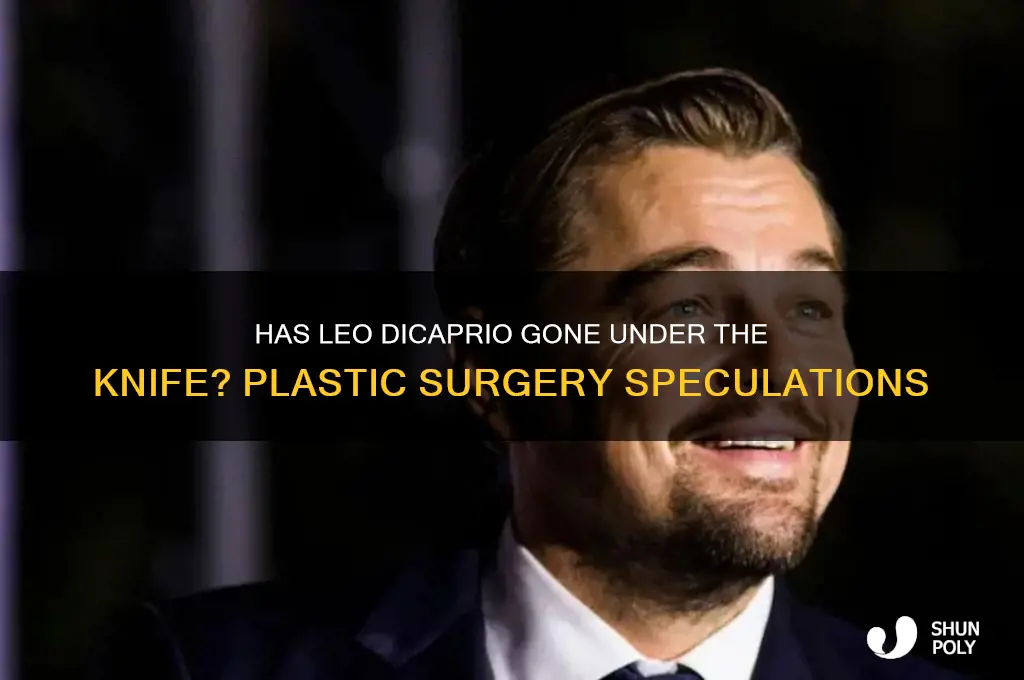 did leo dicaprio had plastic surgery