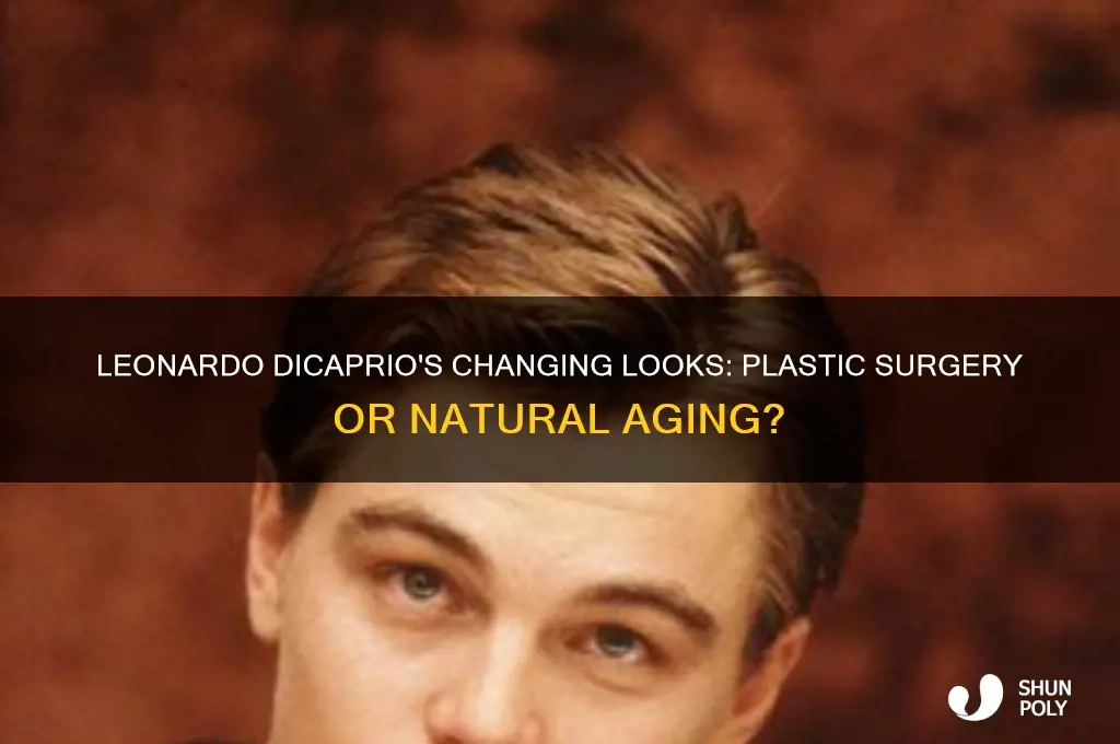 did leonardo dicaprio get plastic surgery
