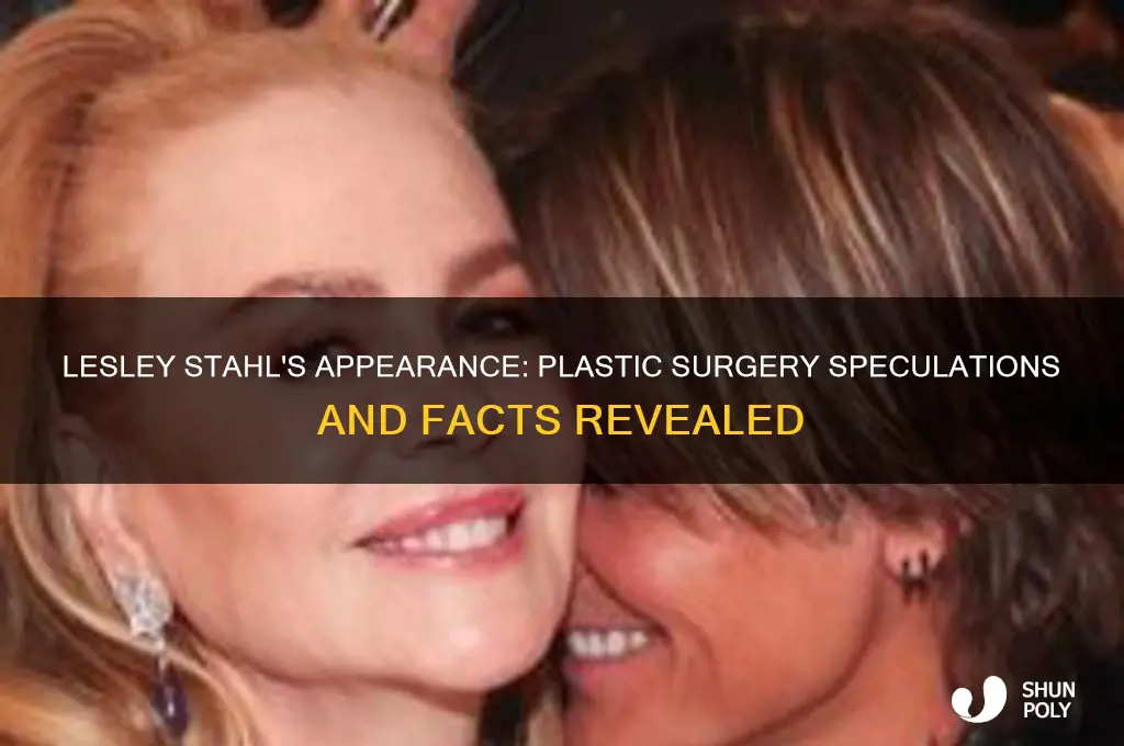 did lesley stahl had plastic surgery