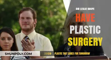 Leslie Knope's Transformation: Plastic Surgery Speculations and Facts Revealed
