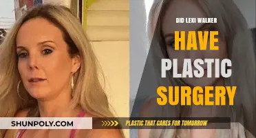 Lexi Walker Plastic Surgery: Fact-Checking the Rumors and Speculations