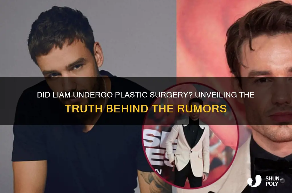 did liam have plastic surgery