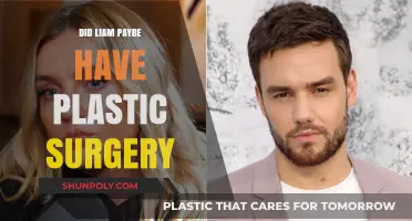 Liam Payne's Transformation: Plastic Surgery Rumors Explored and Debunked