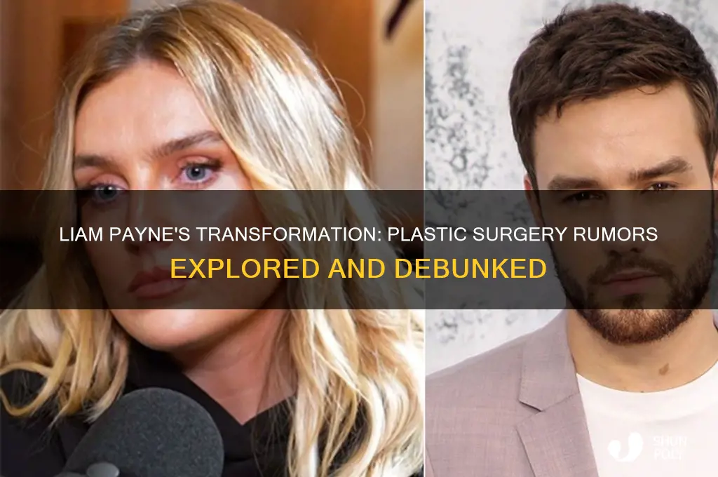 did liam paybe have plastic surgery