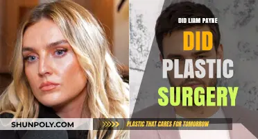 Liam Payne's Transformation: Plastic Surgery Rumors Explored and Debunked