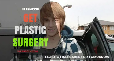 Liam Payne's Transformation: Plastic Surgery Rumors Explored and Debunked