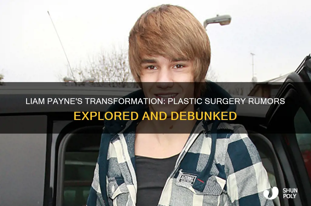 did liam payne get plastic surgery