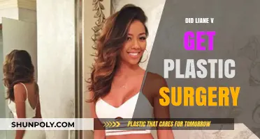 Liane V's Transformation: Plastic Surgery Rumors Explored and Debunked