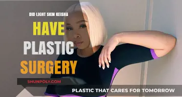 Did Light Skin Keisha Undergo Plastic Surgery? The Truth Revealed