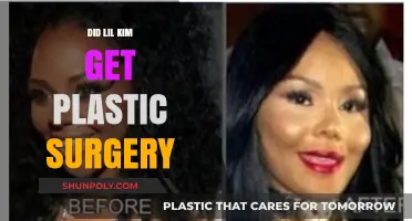 Lil Kim's Transformation: Unveiling the Truth About Her Plastic Surgery