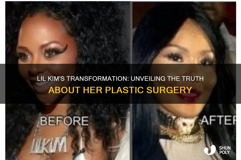did lil kim get plastic surgery