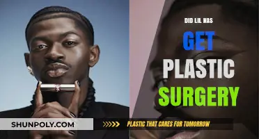 Lil Nas X Plastic Surgery: Fact-Checking the Transformation Rumors
