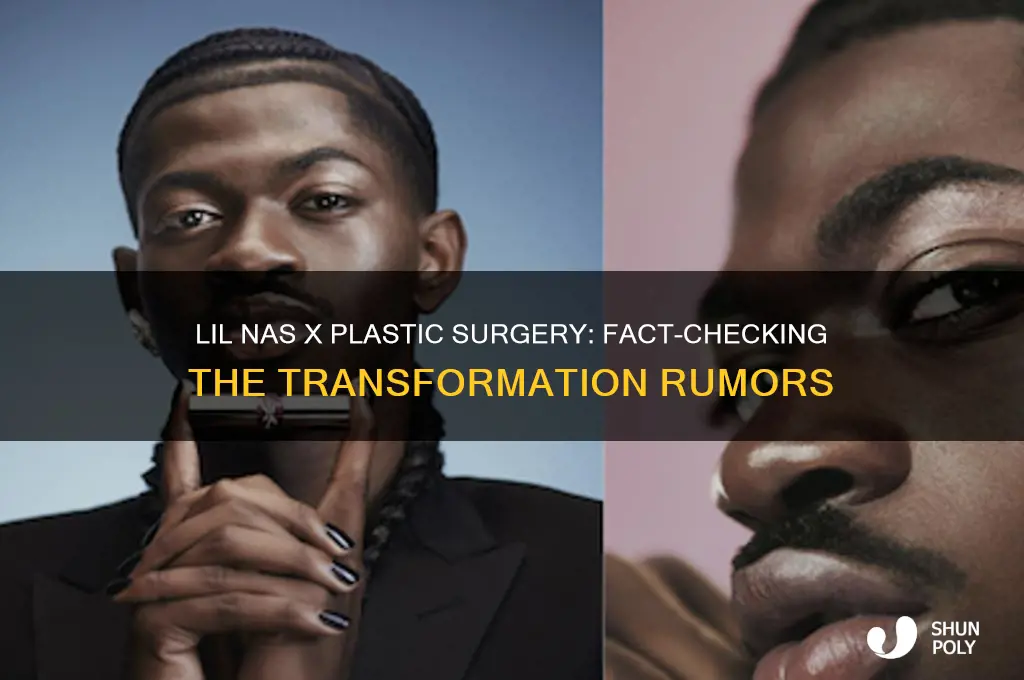 did lil nas get plastic surgery