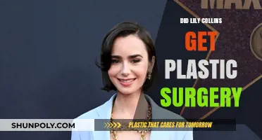 Lily Collins Plastic Surgery: Fact-Checking the Transformation Rumors