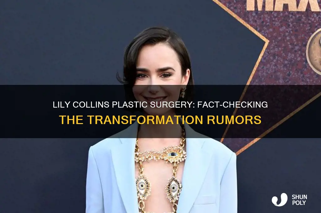 did lily collins get plastic surgery