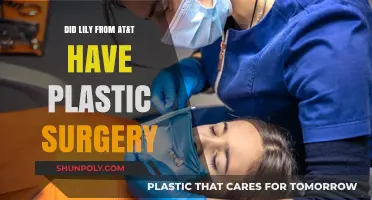 Lily from AT&T Plastic Surgery Rumors: Fact or Fiction?