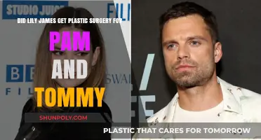Lily James' Transformation: Plastic Surgery for Pam & Tommy?