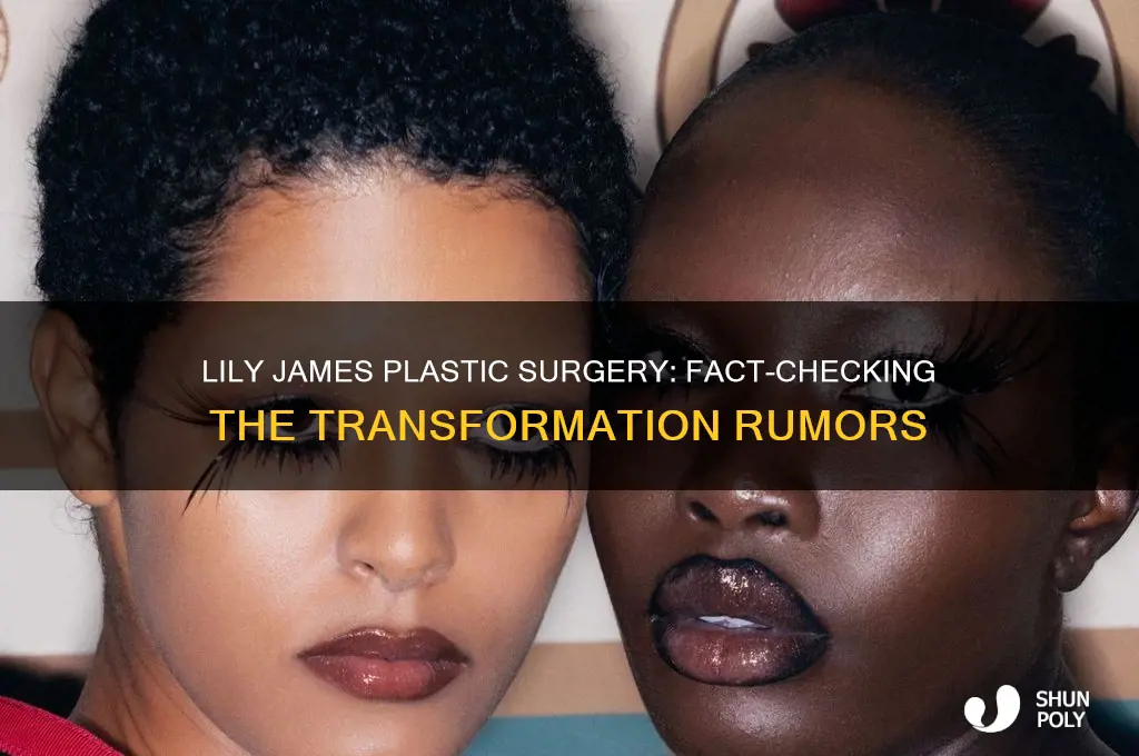 did lily james get plastic surgery