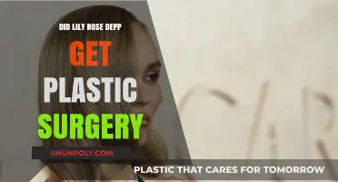 Lily-Rose Depp's Transformation: Plastic Surgery Rumors Explored
